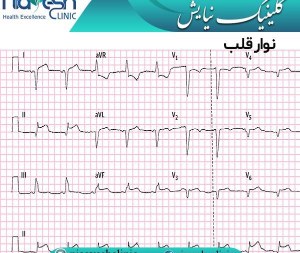 عکس قلب درد زنان