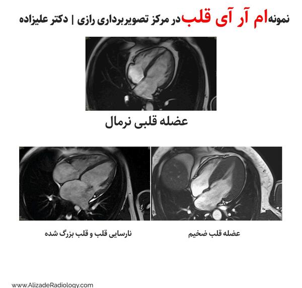 عکس رنگی قلب اصفهان