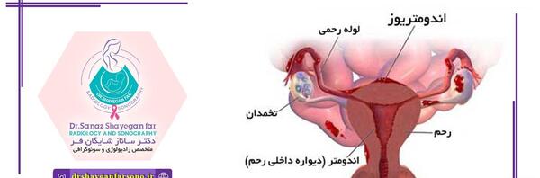 عکس رنگی قلب اصفهان