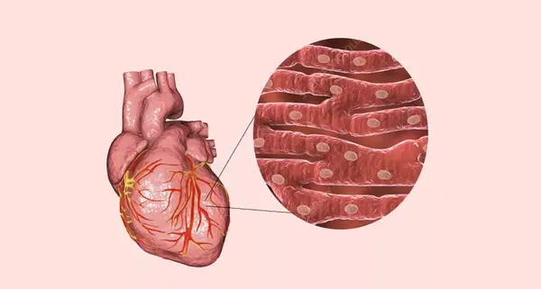 عکس ماهیچه قلب و معده