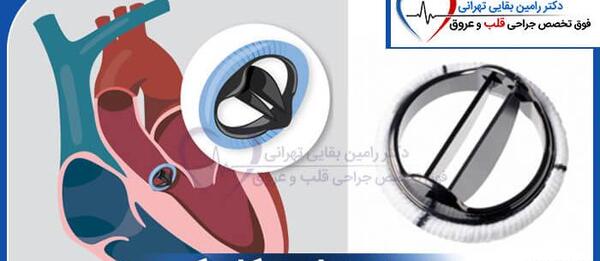 عکس دریچه قلب مصنوعی