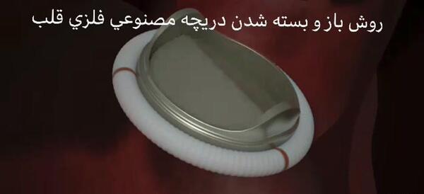 عکس دریچه قلب مصنوعی