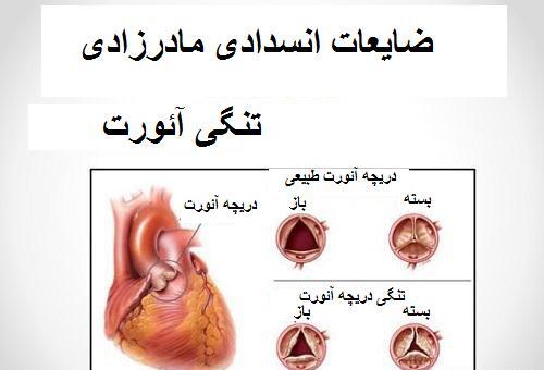 عکس دریچه قلب مصنوعی