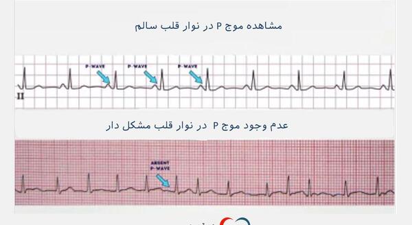 عکس نوار قلب فیک