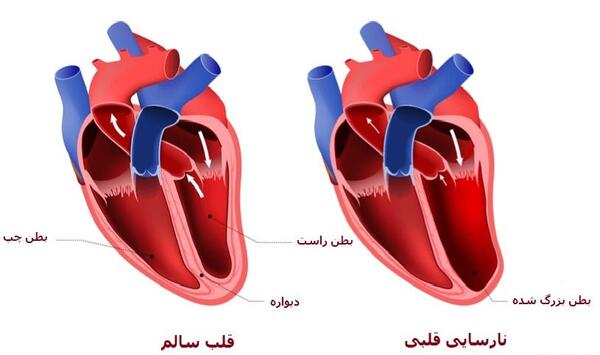 عکس قلب سالم و ناسالم