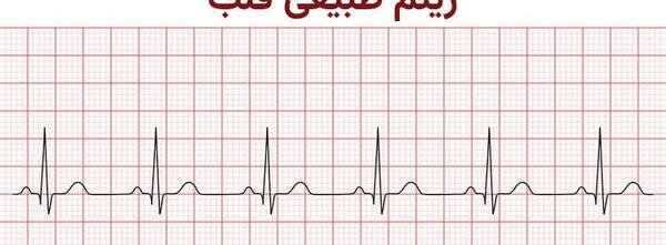 عکس نوار قلب ضعیف
