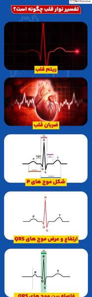 عکس نوار قلب ضعیف