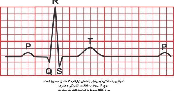 عکس نوار قلب ضعیف