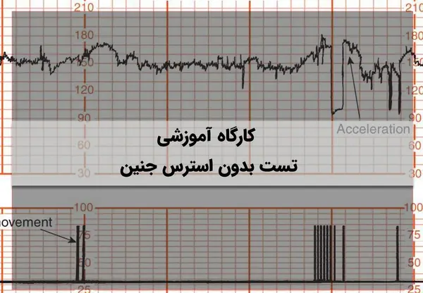 طبیعی عکس نوار قلب سالم