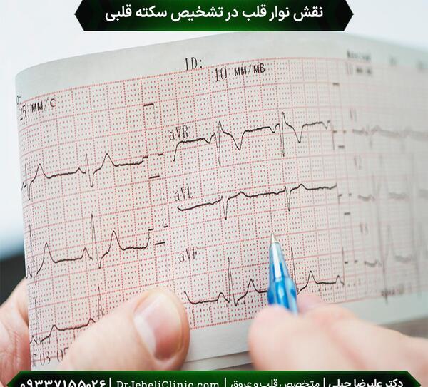 طبیعی عکس نوار قلب سالم