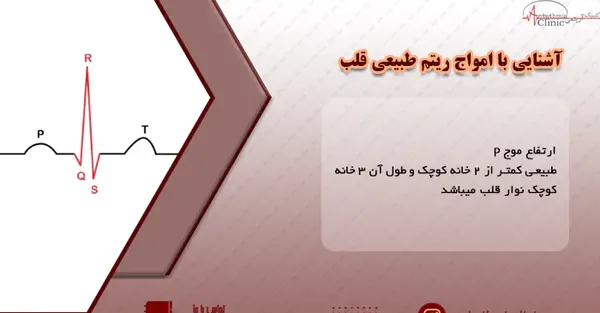 طبیعی عکس نوار قلب سالم