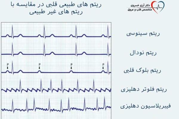 عکس اسکن قلب سالم