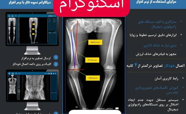 عکس رنگی قلب در اهواز