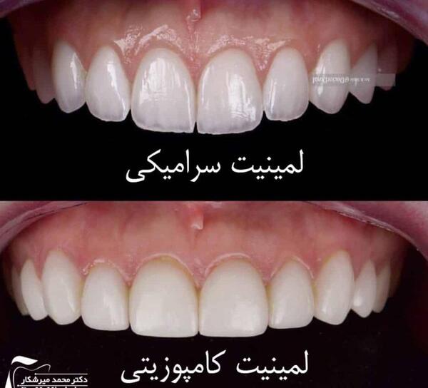 عکس فرشته ی دندان واقعی