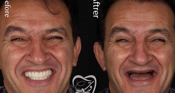 عکس فرشته ی دندان واقعی