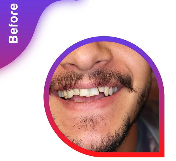 عکس فرشته دندونی واقعی