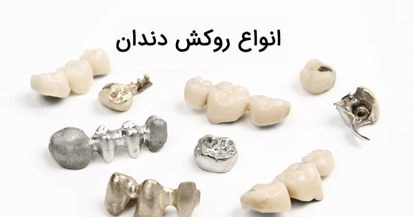 عکس فرشته دندونی واقعی