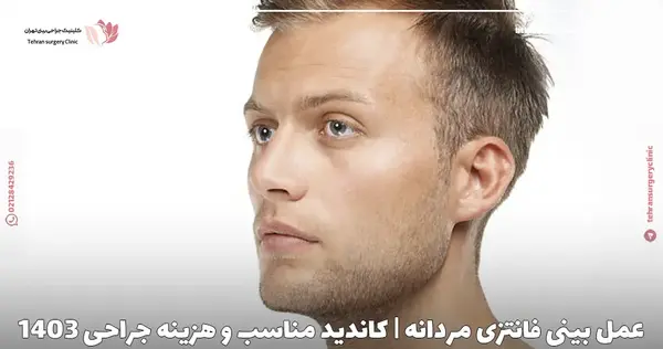 عکس بینی فانتزی مردانه