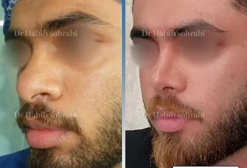 عکس بینی فانتزی مردانه