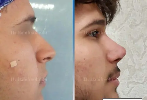 عکس بینی فانتزی مردانه