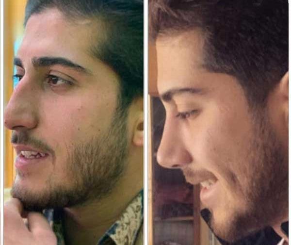 عکس بینی فانتزی مردانه