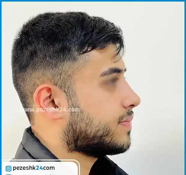 عکس بینی فانتزی مردانه