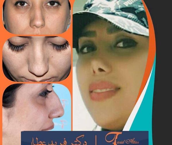عکس بینی فانتزی مردانه