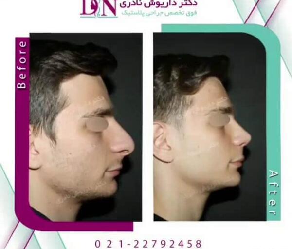 عکس بینی فانتزی مردانه