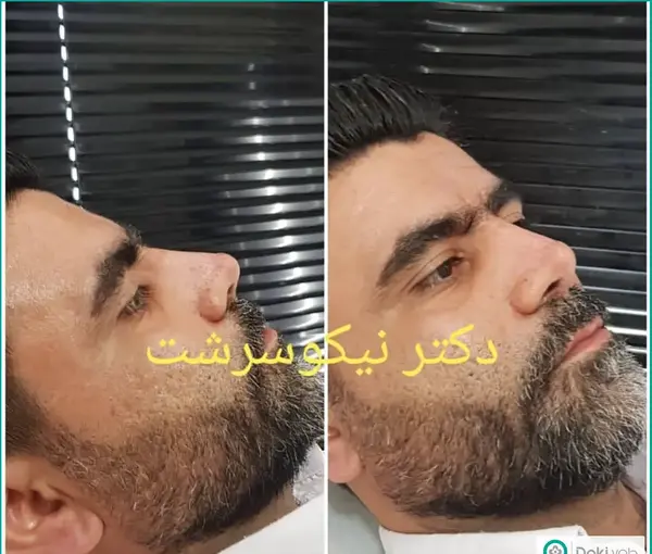 عکس بینی فانتزی مردانه
