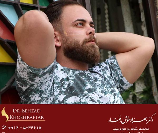 عکس بینی فانتزی مردانه