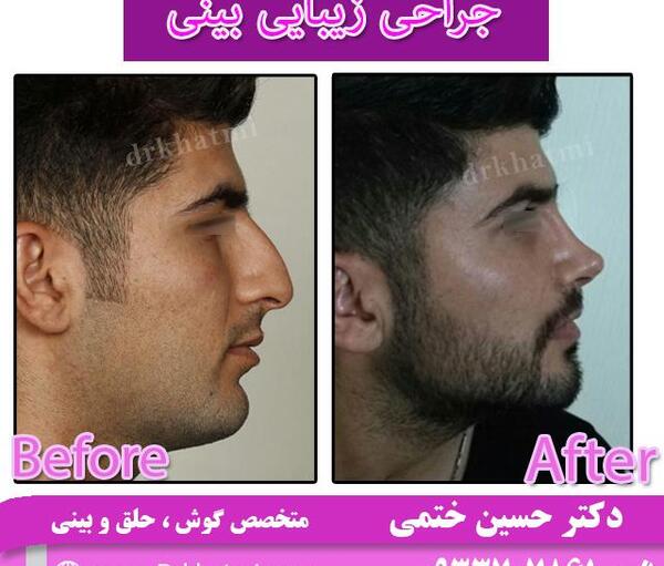 عکس بینی فانتزی مردانه
