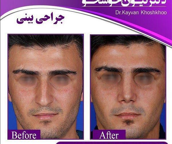 عکس بینی فانتزی مردانه