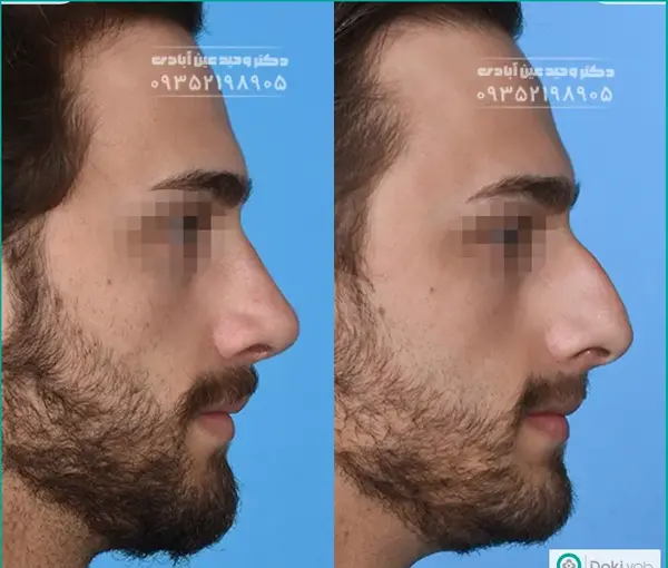عکس بینی فانتزی مردانه