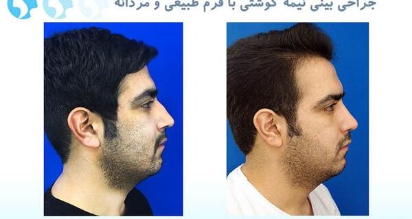 عکس بینی فانتزی مردانه