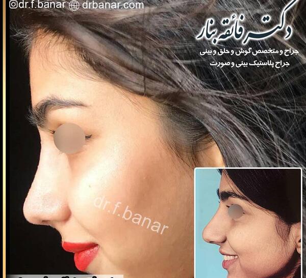 عکس بینی فانتزی مردانه