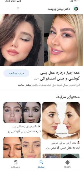 عکس بینی نیمه فانتزی نی نی سایت