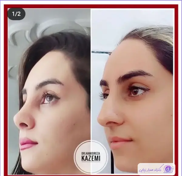 عکس بینی نیمه فانتزی نی نی سایت