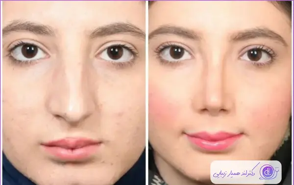 عکس بینی نیمه فانتزی نی نی سایت