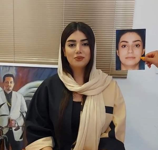 عکس بینی نیمه فانتزی نی نی سایت