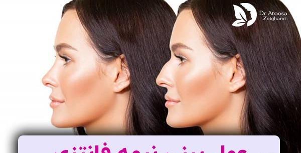 عکس بینی نیمه فانتزی نی نی سایت