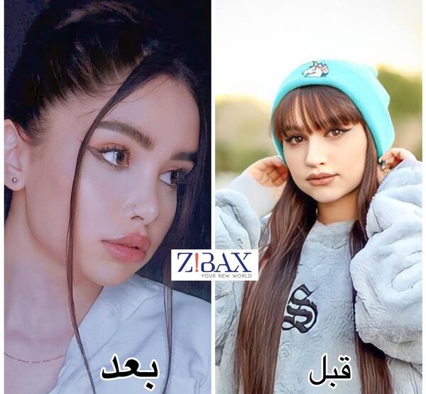 عکس بینی نیمه فانتزی نی نی سایت