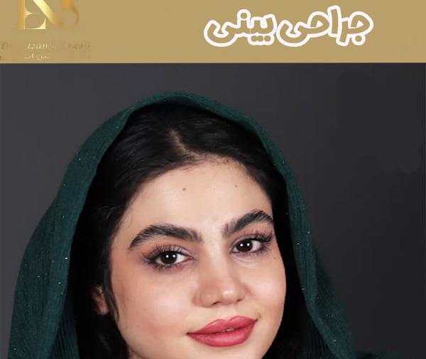 عکس بینی نیمه فانتزی نی نی سایت