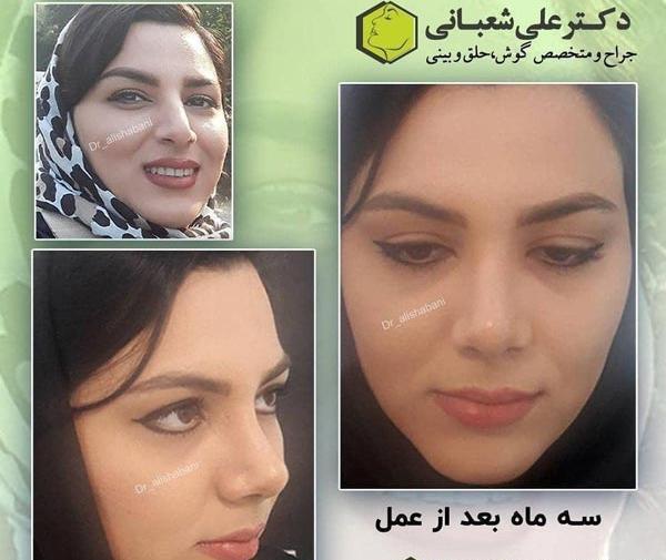 عکس بینی نیمه فانتزی نی نی سایت