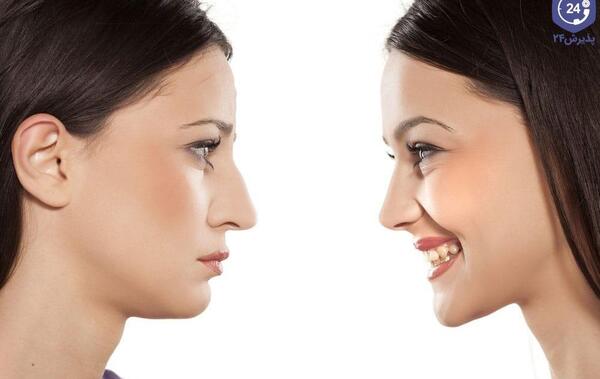 عکس بینی نیمه فانتزی نی نی سایت