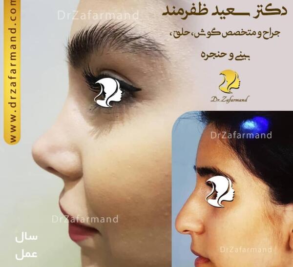 عکس بینی فانتزی عروسکی