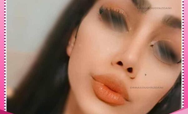 عکس بینی فانتزی عروسکی