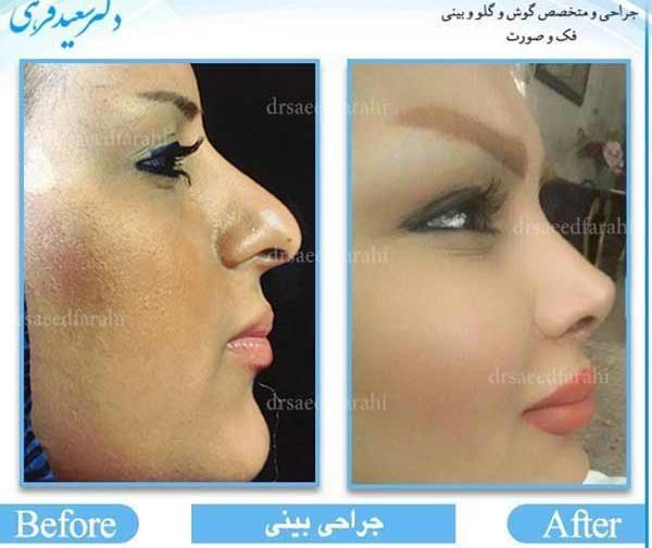 عکس بینی فانتزی عروسکی