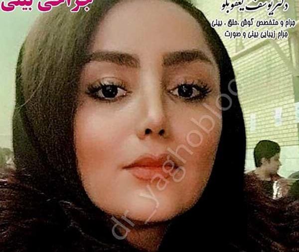 عکس بینی فانتزی عروسکی