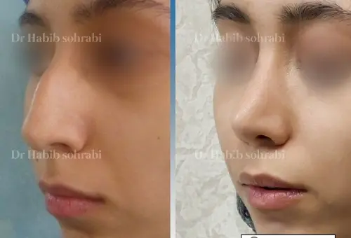 عکس بینی فانتزی عروسکی