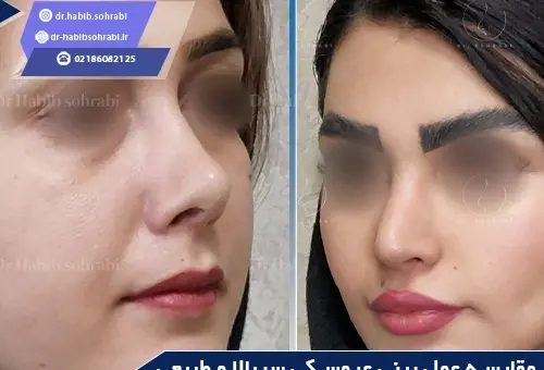 عکس بینی فانتزی عروسکی
